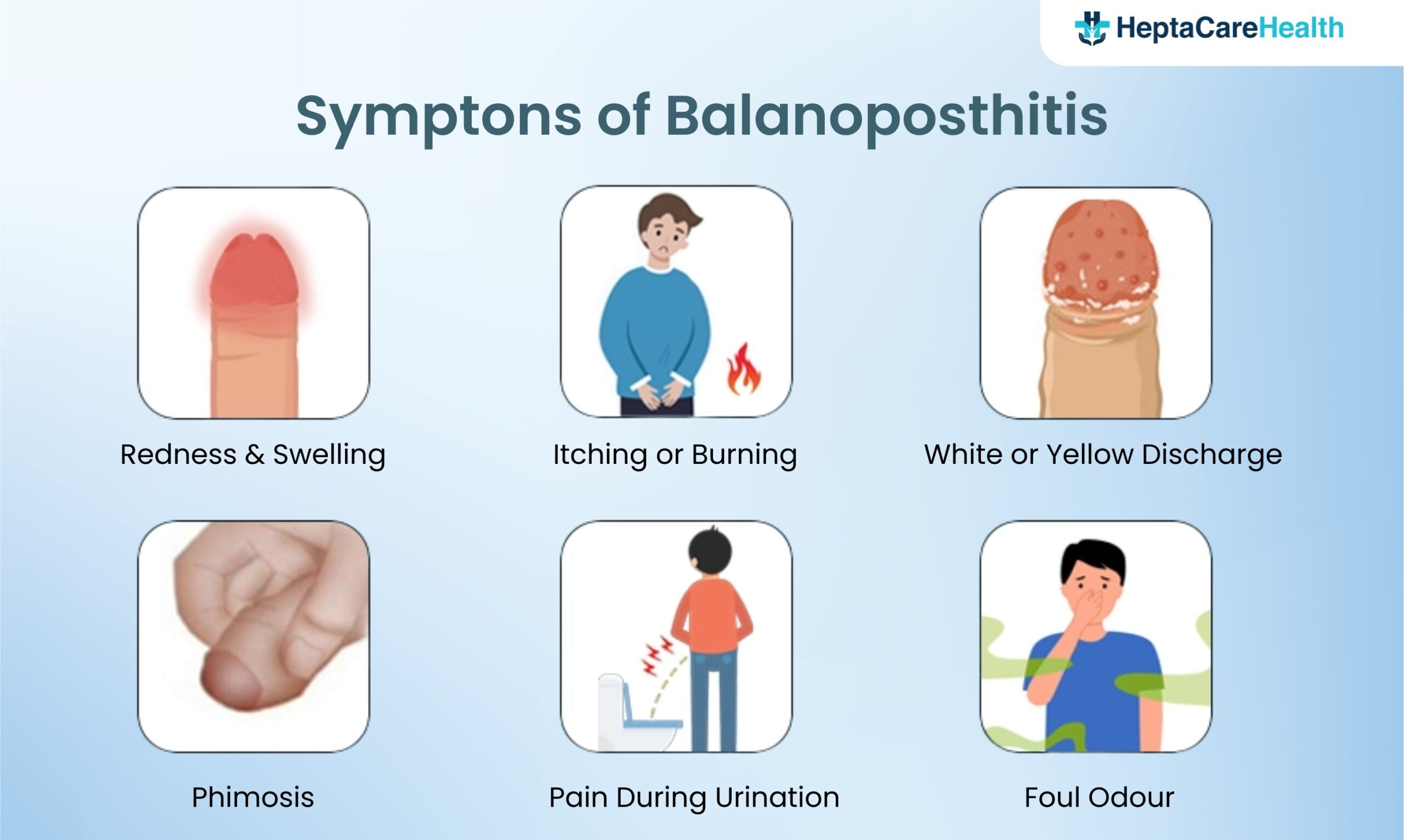 balanoposthitis