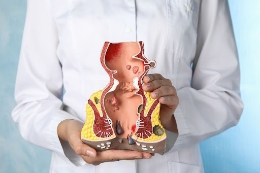Best Proctologist Doctors - HeptaCare Health