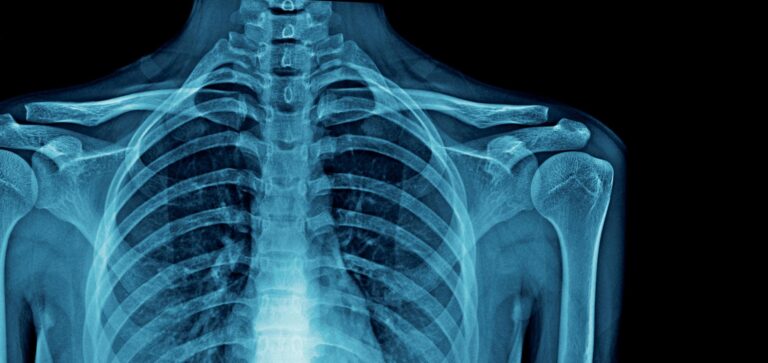 X-rays: Uses, Preparation, Cost & More