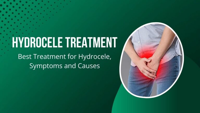 Expert Hydrocele Care: Top Hydrocele Specialist Near Me