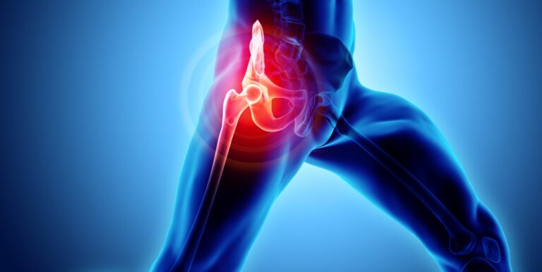 Best Hip Replacement Surgery Near Me | Heptacare Health