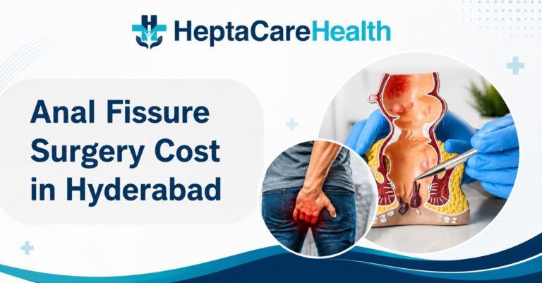 Anal Fissure Surgery Cost in Hyderabad